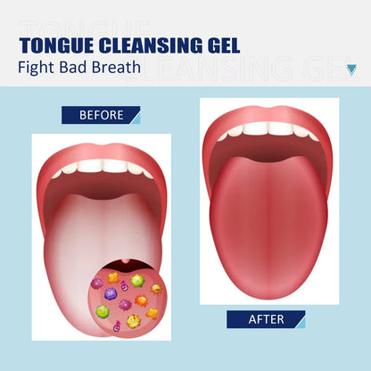 Tongue Cleaning Gel with Brush Oral Care Removal Odor Health Fresh Breath Care Dental Hygiene Tools Coating Cleaning Kit